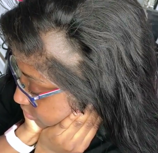 HOW TO FIX A BALDING CLOSURE AND FRONTAL REPLACEMENT